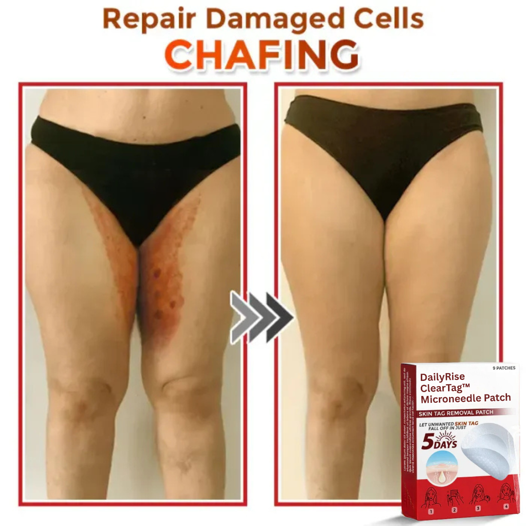 DailyRise ClearTag™ Microneedle Patch