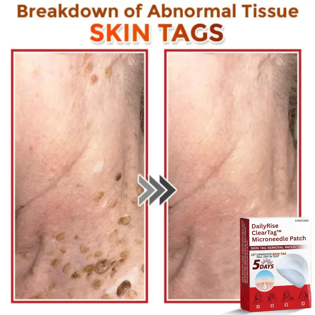 DailyRise ClearTag™ Microneedle Patch