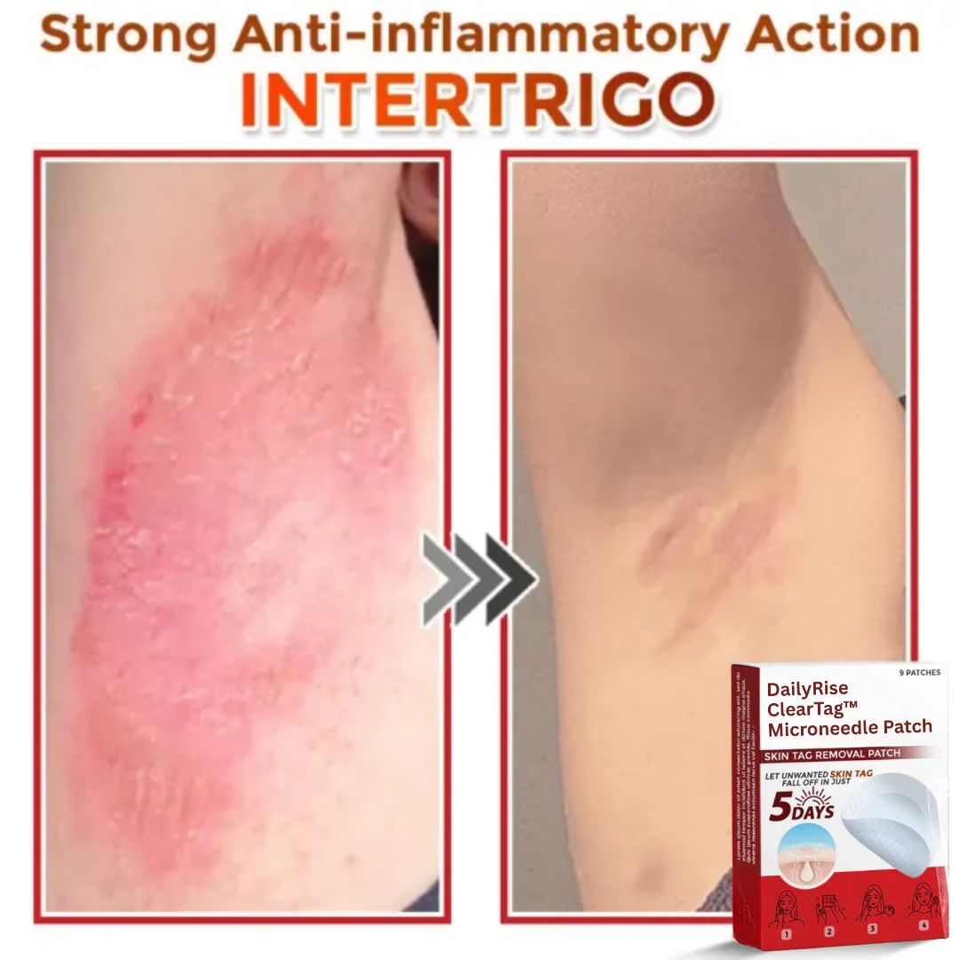 DailyRise ClearTag™ Microneedle Patch