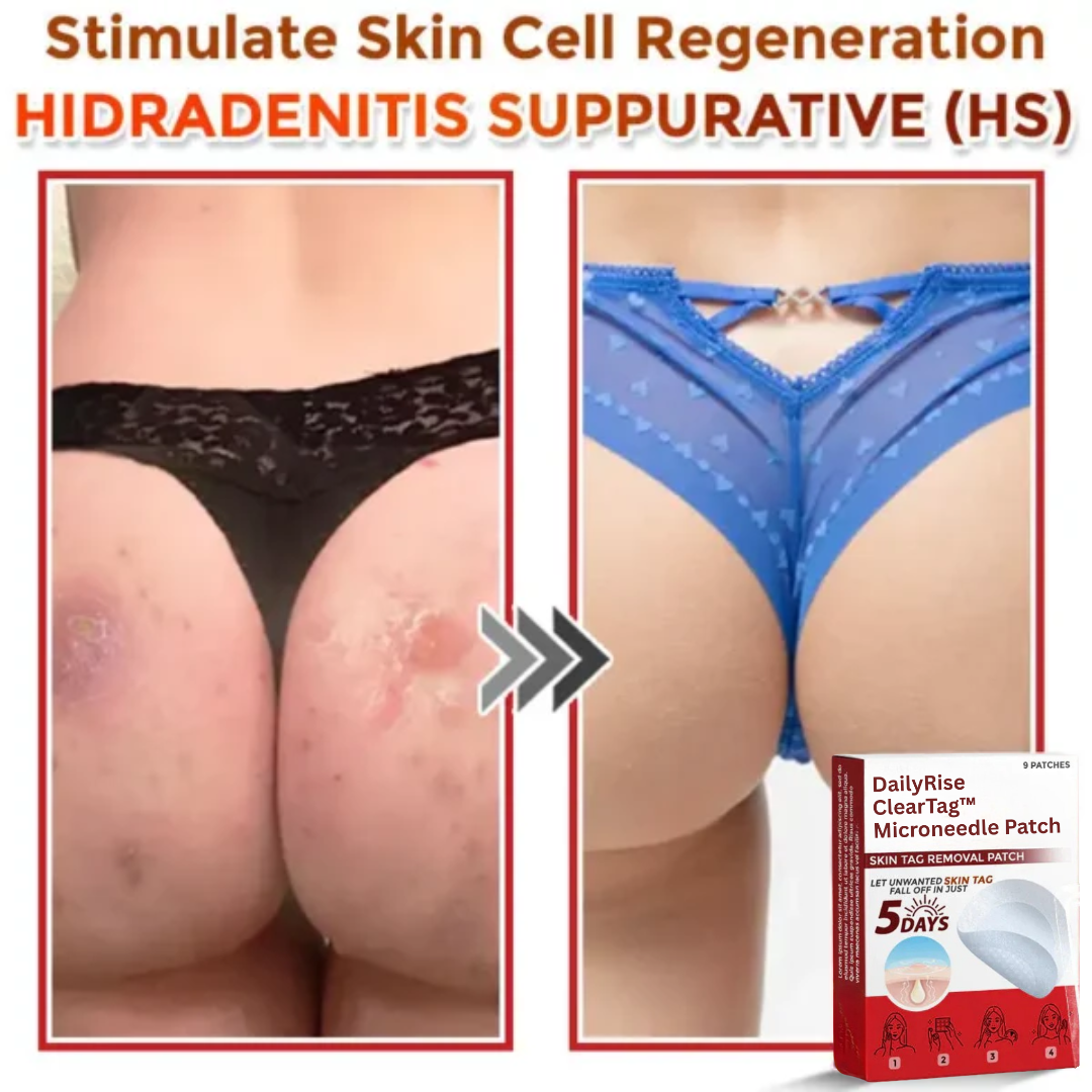 DailyRise ClearTag™ Microneedle Patch