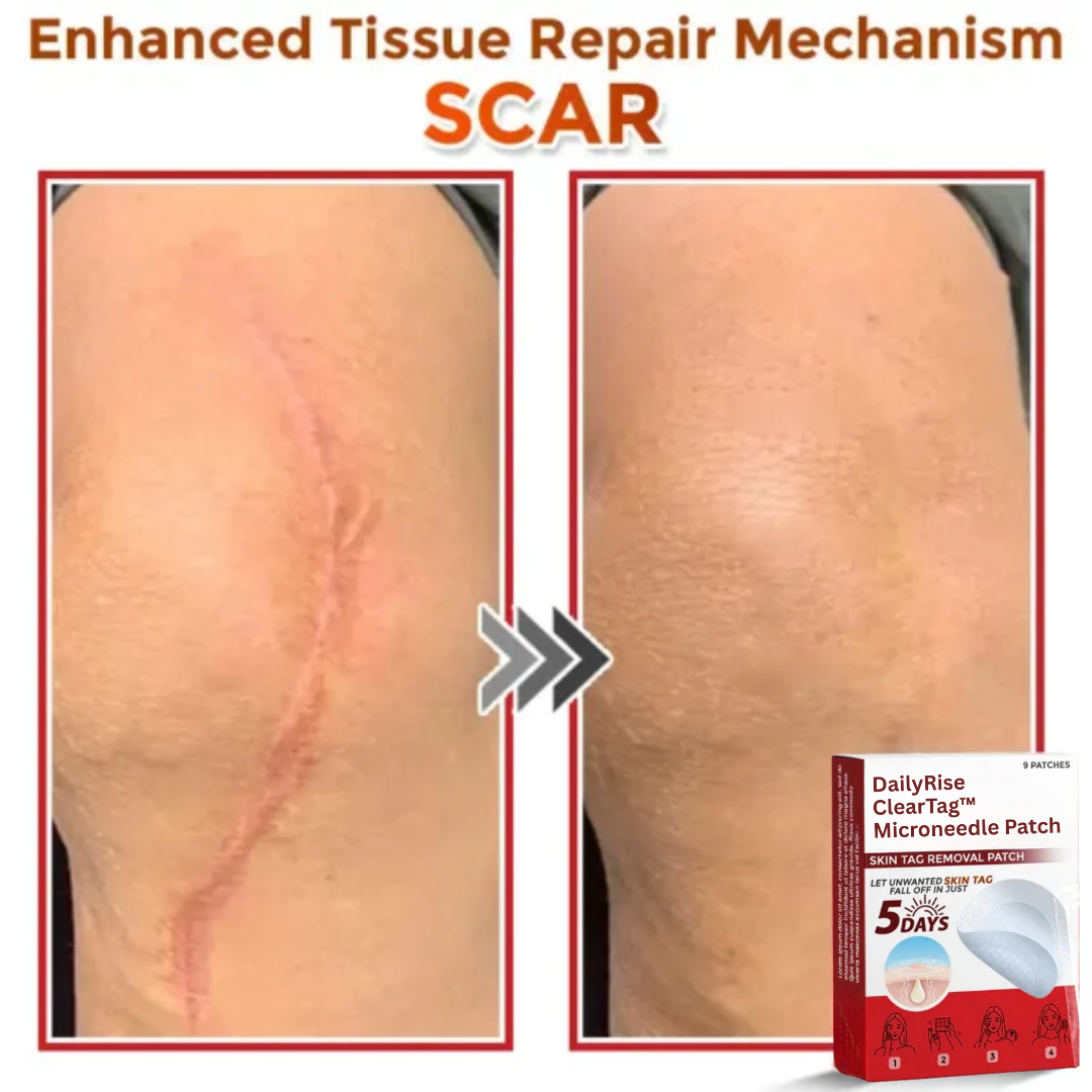 DailyRise ClearTag™ Microneedle Patch